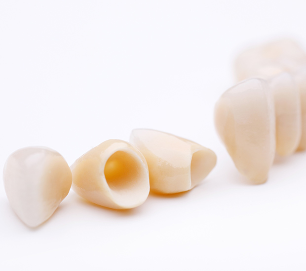 Coconut Creek Dental Crowns and Dental Bridges