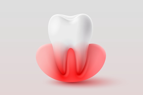 The Danger Of Untreated Gum Disease