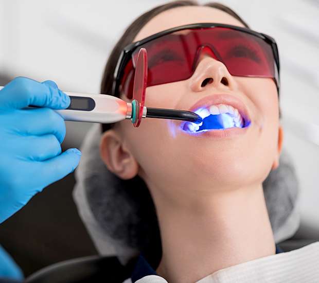 Coconut Creek Professional Teeth Whitening